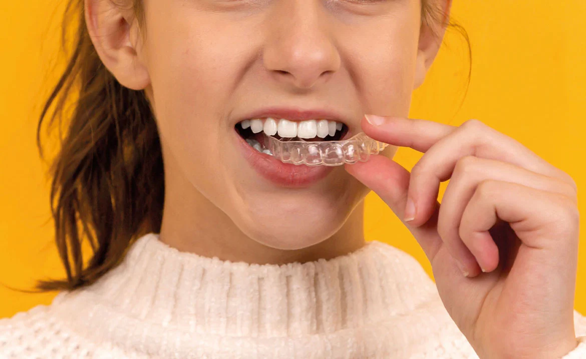 Open Day dell’Ortodonzia